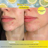 ESW Beauty Deep Detox Pore Control Raw Juice Face Mask