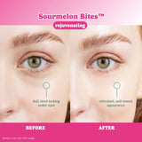 ESW Beauty X Smartsweets Rejuvenating Sourmelon Bites™ Eye Patches